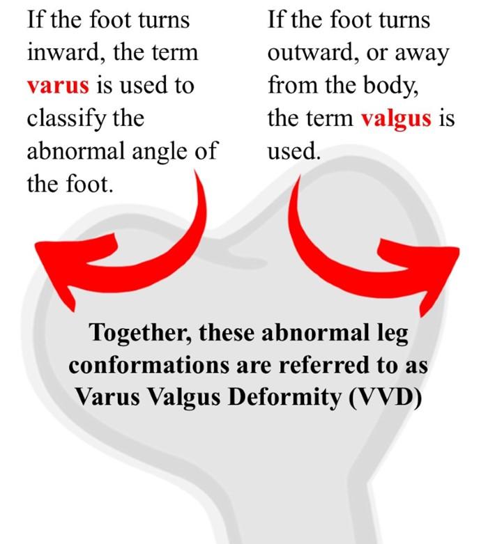 Infographic with bone and two red arrows. 